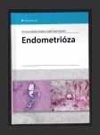 Endometrióza - náhled