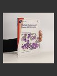 Fast Facts. Multiple Myeloma and Plasma Cell Dyscrasias - náhled